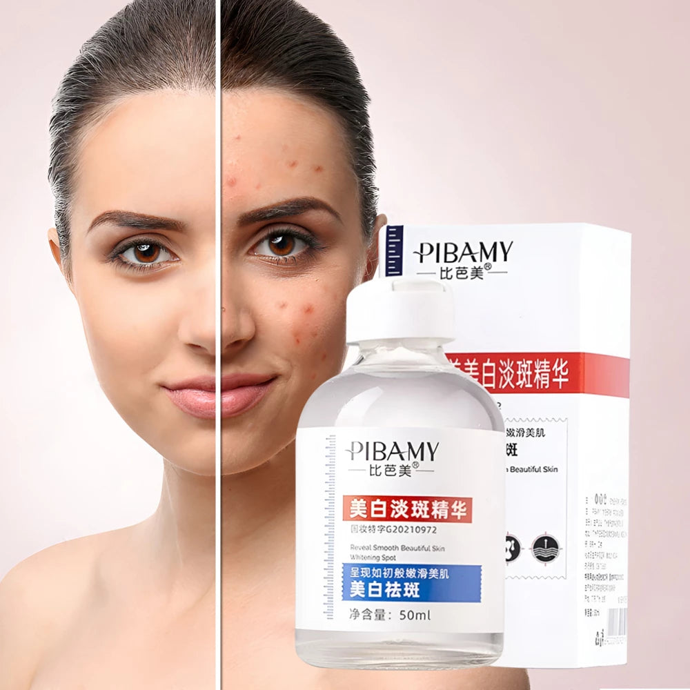 سيروم الوجه السحري لازالة النمش والبقع السوداء ـ Pibamy Black Spot Remover