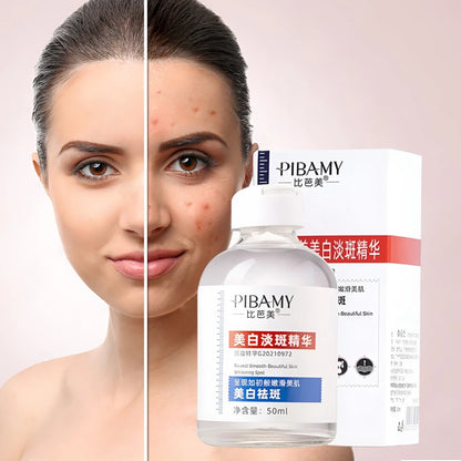 سيروم الوجه السحري لازالة النمش والبقع السوداء ـ Pibamy Black Spot Remover